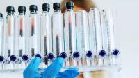 Close-up of a person holding a test tube holder with multiple test tubes